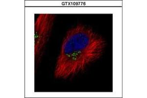 Image no. 2 for anti-Component of Oligomeric Golgi Complex 7 (COG7) (AA 7-286) antibody (ABIN1497558)