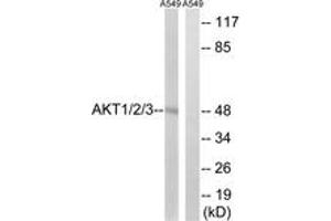 Western blot analysis of extracts from A549 cells, using AKT1/2/3 (Ab-315/316/312) Antibody. (AKT 1/2/3 抗体  (AA 281-330))