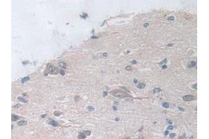 Detection of SOCS2 in Human Cerebrum Tissue using Polyclonal Antibody to Suppressors Of Cytokine Signaling 2 (SOCS2)