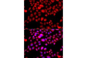 Immunofluorescence analysis of A549 cell using ETFA antibody. (ETFA 抗体)