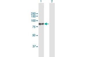 Western Blotting (WB) image for anti-Complement Component 1, S Subcomponent (C1S) (AA 1-688) antibody (ABIN947621)