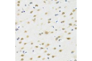Immunohistochemistry (Paraffin-embedded Sections) (IHC (p)) image for anti-Methylthioadenosine phosphorylase (MTAP) (AA 1-283) antibody (ABIN6144119)