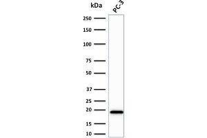 Western Blot Analysis of PC-3 cell lysate using NME2 / nm23-H2 Mouse Monoclonal Antibody (CPTC-NME2-2). (NME2 抗体)