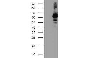 HEK293T cells were transfected with the pCMV6-ENTRY control (Left lane) or pCMV6-ENTRY RNPEP (Right lane) cDNA for 48 hrs and lysed. (RNPEP 抗体)