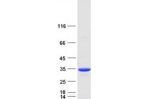Validation with Western Blot