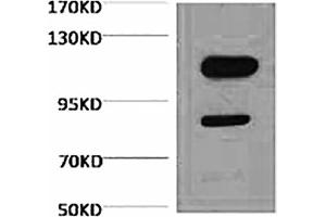Western blot analysis of Jurkat, diluted at 1:3000.