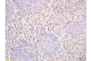 Formalin-fixed and paraffin embedded mouse embryo labeled with Rabbit Anti FLT3L Polyclonal Antibody, Unconjugated (ABIN1714763) at 1:200 followed by conjugation to the secondary antibody and DAB staining (FLT3LG 抗体  (AA 61-160))
