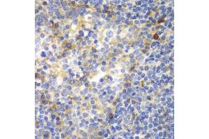 Immunohistochemistry of paraffin-embedded human amygdalitis using ZAP70 antibody. (ZAP70 抗体  (AA 1-300))