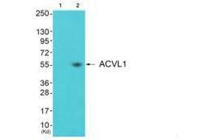 Western blot analysis of extracts from 3T3 cells (Lane 2), using ACVL1 antiobdy. (ACVRL1 抗体)