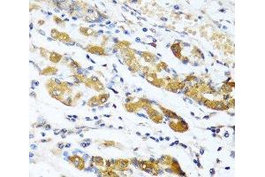 Immunohistochemistry of paraffin-embedded Human stomach using OGN Polyclonal Antibody at dilution of 1:100 (40x lens). (OGN 抗体)