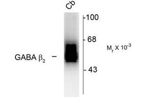 Image no. 2 for anti-gamma-aminobutyric Acid (GABA) A Receptor, beta 2 (GABRB2) (Cytoplasmic Domain) antibody (ABIN228403) (GABRB2 抗体  (Cytoplasmic Domain))