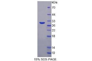 SDS-PAGE analysis of Human DPP3 Protein. (DPP3 蛋白)