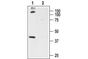 Cannabinoid Receptor 1 (CNR1) peptide