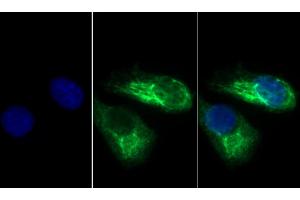 Detection of KRT33A in Human Hela cell using Polyclonal Antibody to Keratin 33A (KRT33A) (Keratin 33A 抗体  (AA 57-363))