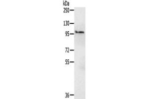 Gel: 6 % SDS-PAGE,Lysate: 40 μg,Primary antibody: ABIN7190553(EMC1 Antibody) at dilution 1/200 dilution,Secondary antibody: Goat anti rabbit IgG at 1/8000 dilution,Exposure time: 15 seconds