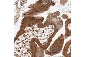 Immunohistochemical staining of human placenta with PITPNM2 polyclonal antibody  shows strong cytoplasmic and nuclear positivity in trophoblastic cells at 1:20-1:50 dilution. (PITPNM2 抗体)
