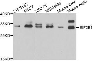 Western blot analysis of extracts of various cell lines, using EIF2B1 antibody. (EIF2B1 抗体)