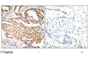 Image no. 1 for anti-Myocyte Enhancer Factor 2A (MEF2A) (pSer408) antibody (ABIN197080) (MEF2A 抗体  (pSer408))