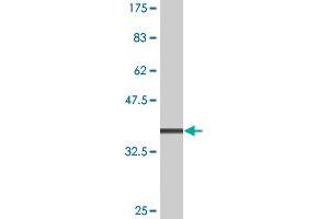 Western Blot detection against Immunogen (36. (Casein Kinase 1 gamma 2 抗体  (AA 315-415))