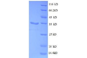 SDS-PAGE (SDS) image for 30S Ribosomal Protein S21 (RpsU) (AA 2-71), (full length) protein (GST tag) (ABIN1046339)