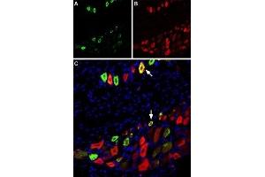Immunohistochemistry (IHC) image for anti-Transient Receptor Potential Cation Channel, Subfamily V, Member 1 (TRPV1) (AA 605-619), (C616S), (Extracellular) antibody (Atto 488) (ABIN7043839)