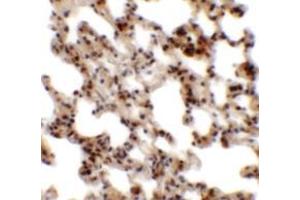 Immunohistochemistry of Coronin 7 in rat lung tissue with Coronin 7 antibody at 2. (Coronin 7 抗体  (C-Term))