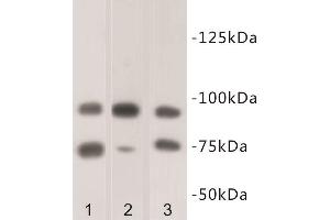Western Blotting (WB) image for anti-SUZ12 Polycomb Repressive Complex 2 Subunit (SUZ12) antibody (ABIN1854978) (SUZ12 抗体)