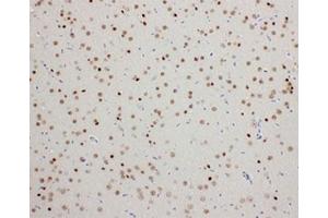 Immunohistochemistry (IHC) image for anti-Pyruvate Dehydrogenase Kinase, Isozyme 2 (PDK2) (C-Term) antibody (ABIN3032416)