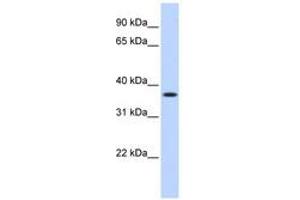 Image no. 1 for anti-Methylenetetrahydrofolate Dehydrogenase (NADP+ Dependent) 2, Methenyltetrahydrofolate Cyclohydrolase (MTHFD2) (AA 180-229) antibody (ABIN6740950) (MTHFD2 抗体  (AA 180-229))