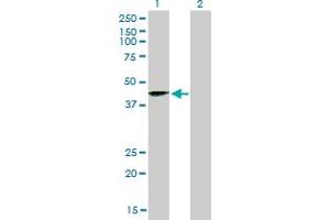 Western Blot analysis of SIRT2 expression in transfected 293T cell line by SIRT2 monoclonal antibody (M01), clone 4B11. (SIRT2 抗体  (AA 128-227))