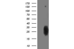 Western Blotting (WB) image for anti-phosphoglycerate Mutase 2 (Muscle) (PGAM2) antibody (ABIN1500172) (PGAM2 抗体)