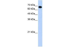 WB Suggested Anti-CCDC38 Antibody Titration: 0. (CCDC38 抗体  (N-Term))