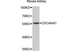 Western blot analysis of extracts of mouse kidney, using ZSCAN4 antibody (ABIN4905688) at 1:1000 dilution. (ZSCAN4C 抗体)