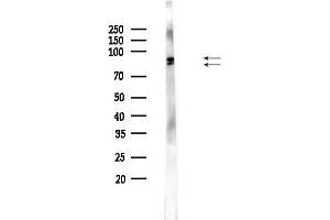 Western blot analysis of lysates from PC12 cells, using Phospho-RSK2 (Ser227) Antibody at 1/1000 dilution.