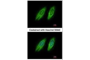 Immunofluorescence (IF) image for anti-Golgi Brefeldin A Resistant Guanine Nucleotide Exchange Factor 1 (GBF1) (N-Term) antibody (ABIN2855449)