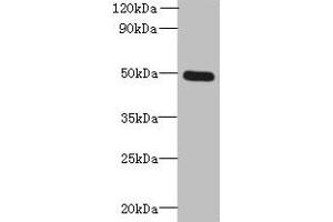 Western blot All lanes: TTYH1 antibody at 4 μg/mL + Raji whole cell lysate Secondary Goat polyclonal to rabbit IgG at 1/10000 dilution Predicted band size: 50, 27, 36 kDa Observed band size: 50 kDa (TTYH1 抗体  (AA 50-178))