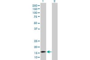 Western Blot analysis of NUDT2 expression in transfected 293T cell line by NUDT2 MaxPab polyclonal antibody. (NUDT2 抗体  (AA 1-147))