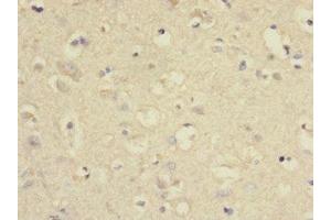 Immunohistochemistry of paraffin-embedded human brain tissue using ABIN7166579 at dilution of 1:100 (SLC2A13 抗体  (AA 564-648))
