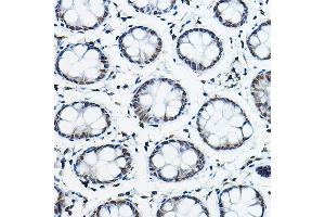 Immunohistochemistry of paraffin-embedded human colon using NCOR2 Rabbit pAb (ABIN6130575, ABIN6144422, ABIN6144423 and ABIN6224431) at dilution of 1:100 (40x lens). (NCOR2 抗体  (AA 670-900))