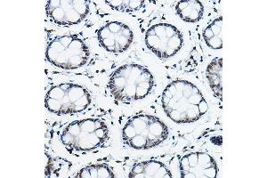 Immunohistochemistry of paraffin-embedded human colon using NCOR2 Rabbit pAb (ABIN6130575, ABIN6144422, ABIN6144423 and ABIN6224431) at dilution of 1:100 (40x lens). (NCOR2 抗体  (AA 670-900))