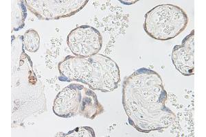 Image no. 4 for anti-Interleukin 15 (IL15) antibody (ABIN464931) (IL-15 抗体)