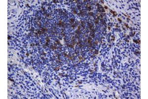 Immunohistochemistry (IHC) image for anti-T-cell surface glycoprotein CD1c (CD1C) antibody (ABIN2670676) (CD1c 抗体)