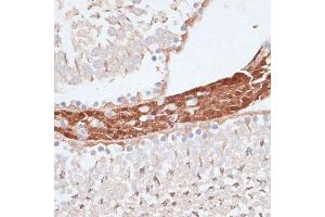 Immunohistochemistry (IHC) image for anti-Kinesin Family Member C1 (KIFC1) (AA 1-250) antibody (ABIN1680592)