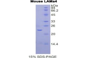 SDS-PAGE analysis of Mouse Laminin alpha 4 Protein. (LAMa4 蛋白)