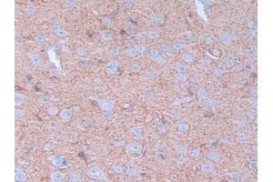 Detection of LXN in Rat Brain Tissue using Polyclonal Antibody to Latexin (LXN)