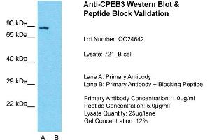 Host: Rabbit  Target Name: CPEB3  Sample Tissue: 721_B Whole Cell  Lane A:  Primary Antibody Lane B:  Primary Antibody + Blocking Peptide Primary Antibody Concentration: 1 µg/mL Peptide Concentration: 2 µg/mL Lysate Quantity: 241 µg/laneGel Concentration: 2. (CPEB3 抗体  (Middle Region))