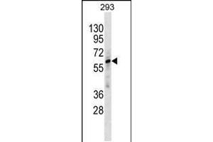 Western blot analysis in 293 cell line lysates (35ug/lane). (ZNF775 抗体  (C-Term))