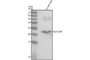 anti-Retinoschisin 1 (RS1) (AA 34-224) antibody