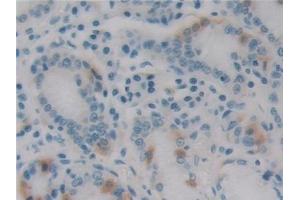 Detection of EBI3 in Human Stomach Tissue using Monoclonal Antibody to Epstein Barr Virus Induced Protein 3 (EBI3) (EBI3 抗体  (AA 21-229))