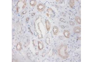 Immunohistochemistry of paraffin-embedded human kidney using ZNF91 antibody at dilution 1:100. (ZFP91 抗体  (FITC))